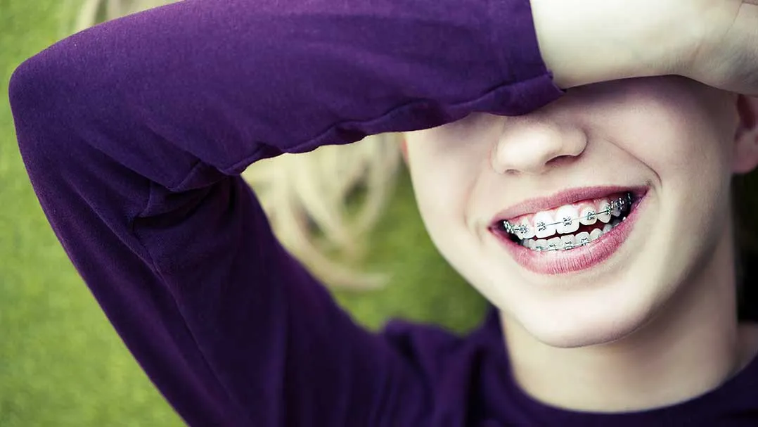 A child smiles to reveal braces